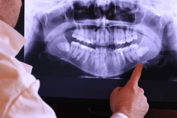Best Weekend Emergency Dentist in San Angelo, TX