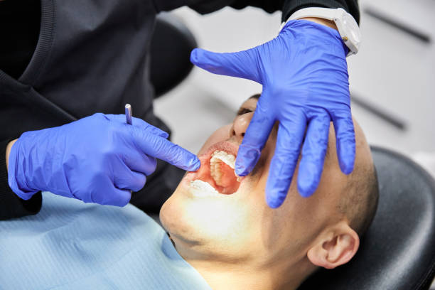 Best Emergency Treatment for Toothache in San Angelo, TX
