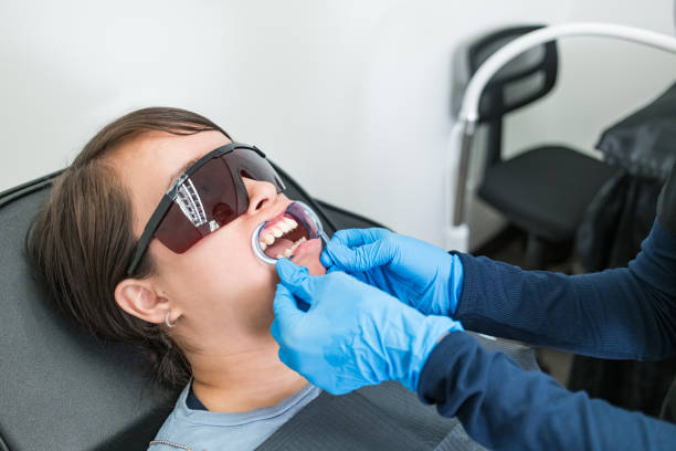 Best Emergency Wisdom Teeth Removal in San Angelo, TX